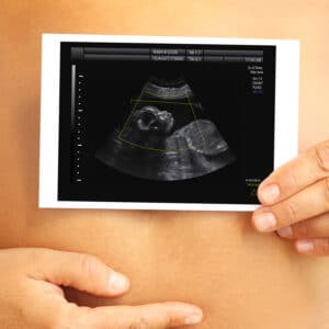 Surrogacy Modern Family Planning Technologies and the Law